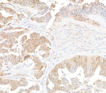 Mouse anti-p16INK4a Recombinant Monoclonal Antibody