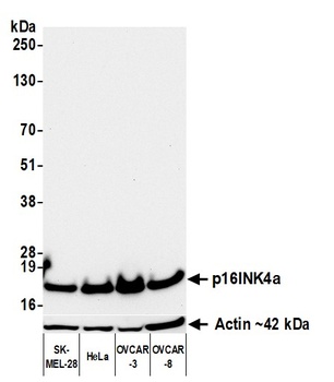 Mouse anti-p16INK4a Recombinant Monoclonal Antibody
