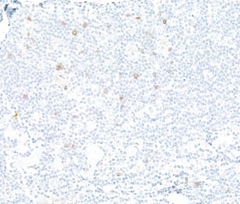 Rabbit anti-NKG2A Recombinant Monoclonal Antibody