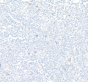 Rabbit anti-NKG2A Recombinant Monoclonal Antibody