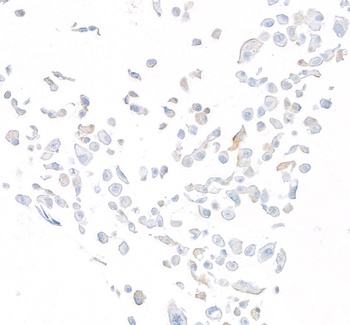 Rabbit anti-DPP4/CD26 Recombinant Monoclonal Antibody
