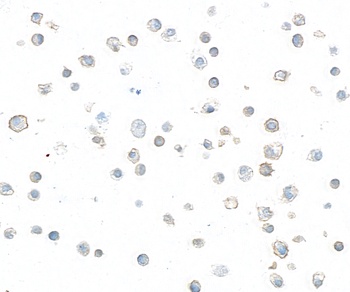 Rabbit anti-LAG3 Recombinant Monoclonal Antibody