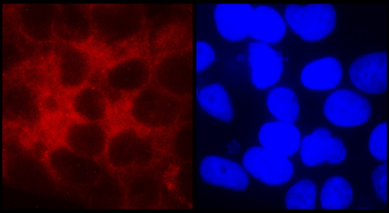 PPARγ Rabbit Polyclonal Antibody