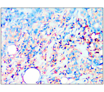 PPARγ Rabbit Polyclonal Antibody
