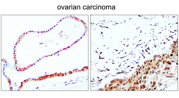 PPARγ Rabbit Polyclonal Antibody