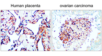 PPARγ Rabbit Polyclonal Antibody