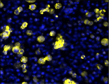 Claudin-1/CLDN1 Antibody