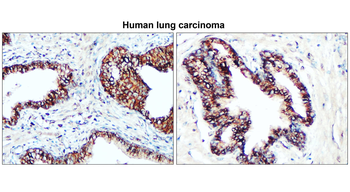 Claudin-1/CLDN1 Antibody