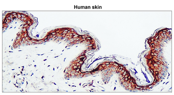 Claudin-1/CLDN1 Antibody
