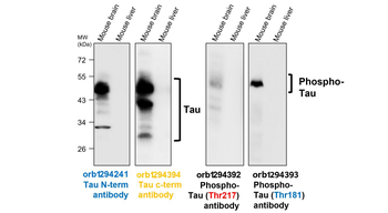 Tau N-terminal Rabbit Polyclonal Antibody