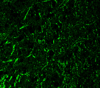 Tau N-terminal Rabbit Polyclonal Antibody