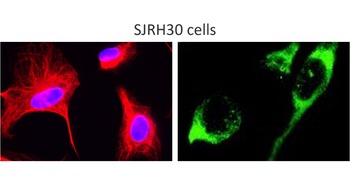 Desmin Mouse Monoclonal Antibody