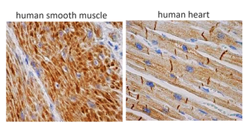 Desmin Mouse Monoclonal Antibody