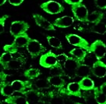 NLRP3 Rabbit Polyclonal Antibody