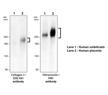 Fibronectin 1/FN1 (C-term) Antibody