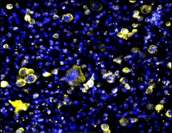 Fibronectin 1/FN1 (C-term) Antibody