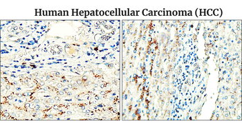 Fibronectin 1/FN1 (C-term) Antibody