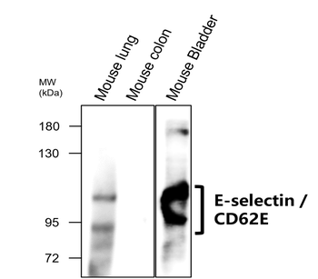E-selectin | CD62E Rabbit Polyclonal Antibody