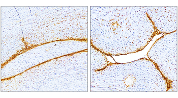 E-selectin | CD62E Rabbit Polyclonal Antibody