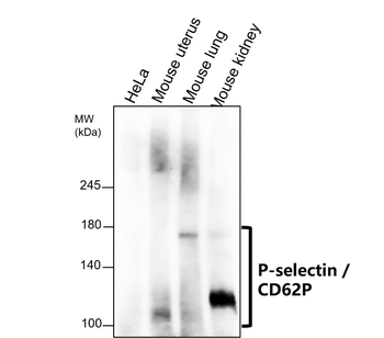 P-selectin | CD62P Rabbit Polyclonal Antibody
