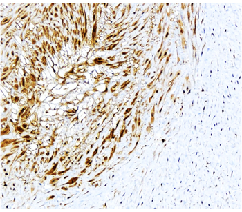 P-selectin | CD62P Rabbit Polyclonal Antibody