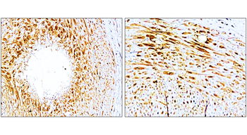 P-selectin | CD62P Rabbit Polyclonal Antibody