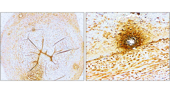 P-selectin | CD62P Rabbit Polyclonal Antibody