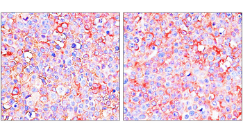 ST3GAL1/SIAT4A Antibody