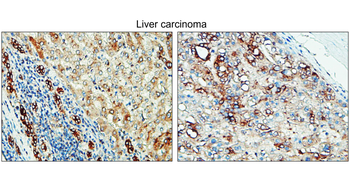 Tissue Factor/CD142 extracellular Antibody