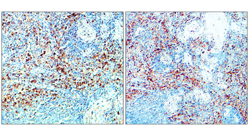 CD206/Mannose Receptor/MRC1 Antibody