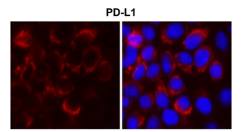 PD-L1/CD274 Intracellular domain (IHC prefer) Antibody