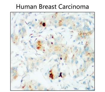 PD-L1/CD274 Intracellular domain (IHC prefer) Antibody