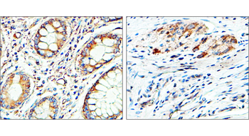 EEA1 Rabbit Polyclonal Antibody