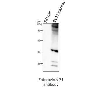 Enterovirus 71/EV71 Antibody