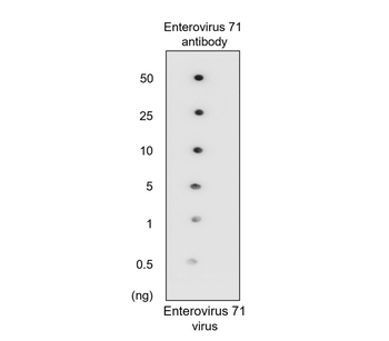 Enterovirus 71/EV71 Antibody