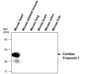 Troponin I Rabbit Polyclonal Antibody