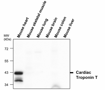 Troponin T Rabbit Polyclonal Antibody