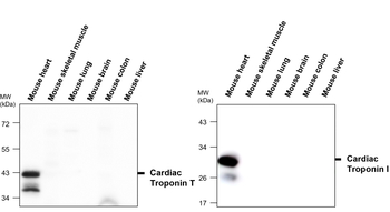 Troponin T Rabbit Polyclonal Antibody