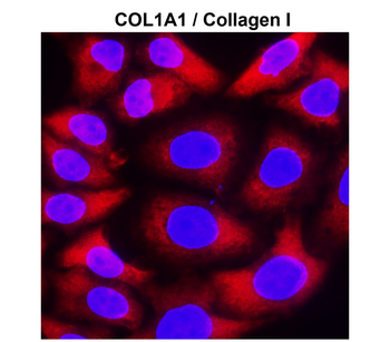 COL1A1/Collagen I Antibody