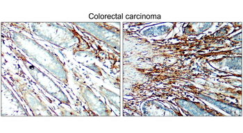 COL1A1/Collagen I Antibody