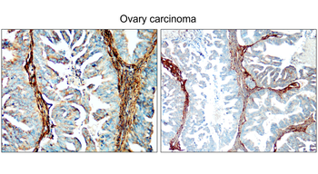 COL1A1/Collagen I Antibody