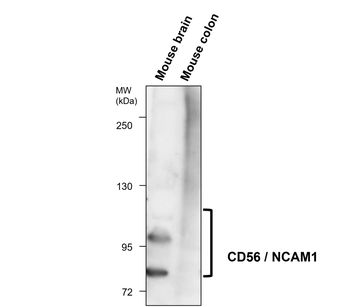 CD56/NCAM1 Antibody