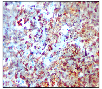 CD19 Antibody