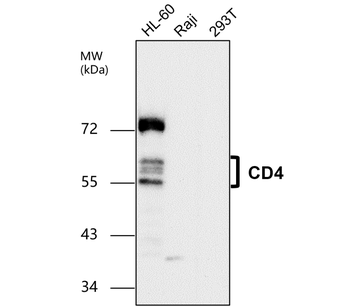 CD4 Rabbit Polyclonal Antibody