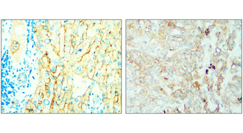Syndecan-1/CD138 Extracellular domain Antibody