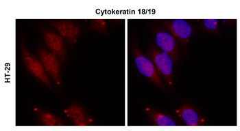 Cytokeratin 18/19, CK18/19 Antibody