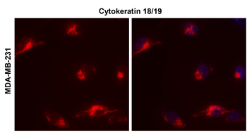 Cytokeratin 18/19, CK18/19 Antibody