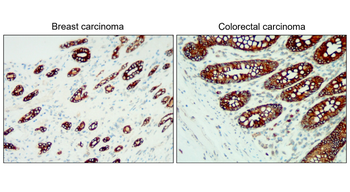 Cytokeratin 18/19, CK18/19 Antibody