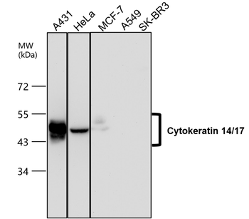 Cytokeratin 14 Rabbit Polyclonal Antibody