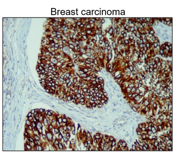 Cytokeratin 14 Rabbit Polyclonal Antibody